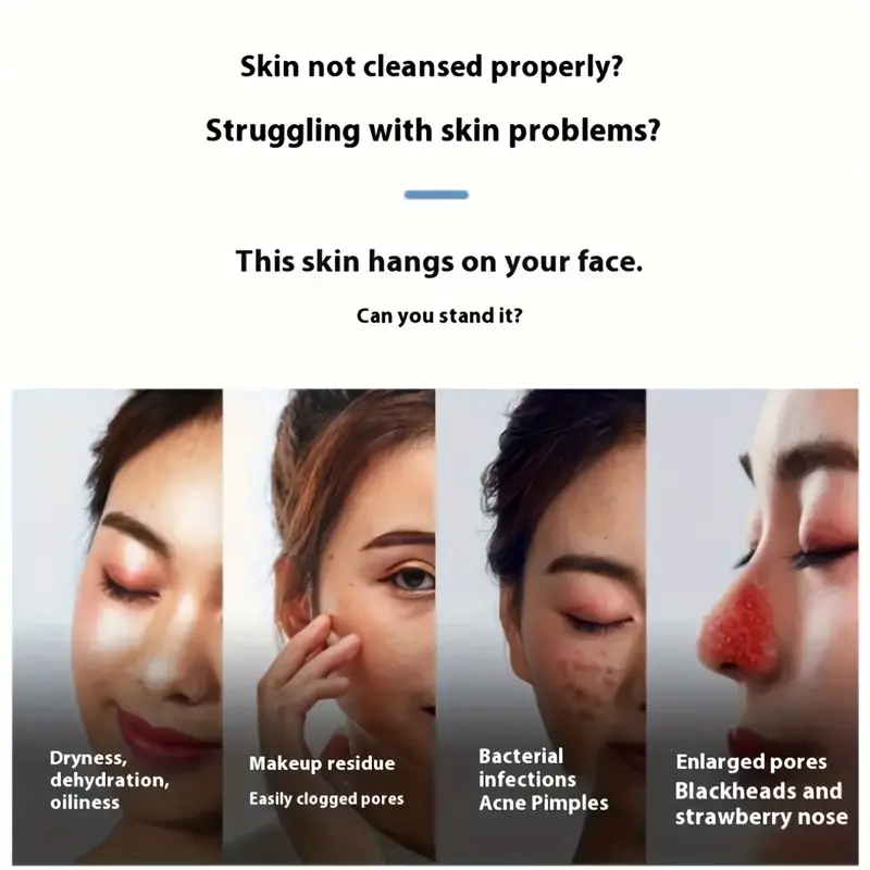 Electric Blackhead, Pimple Remover & Pores Cleaner