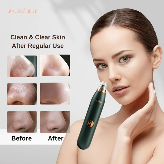Electric Blackhead, Pimple Remover & Pores Cleaner